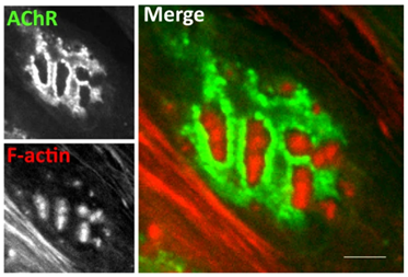 Microscopy image of actin-rich podosomes. Figure 4G, Pęziński et al. 2020 Sci Rep (CC BY 4.0).